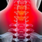 Profile picture of CervicalSpineSurgeon