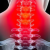 Profile picture of CervicalSpineSurgeon